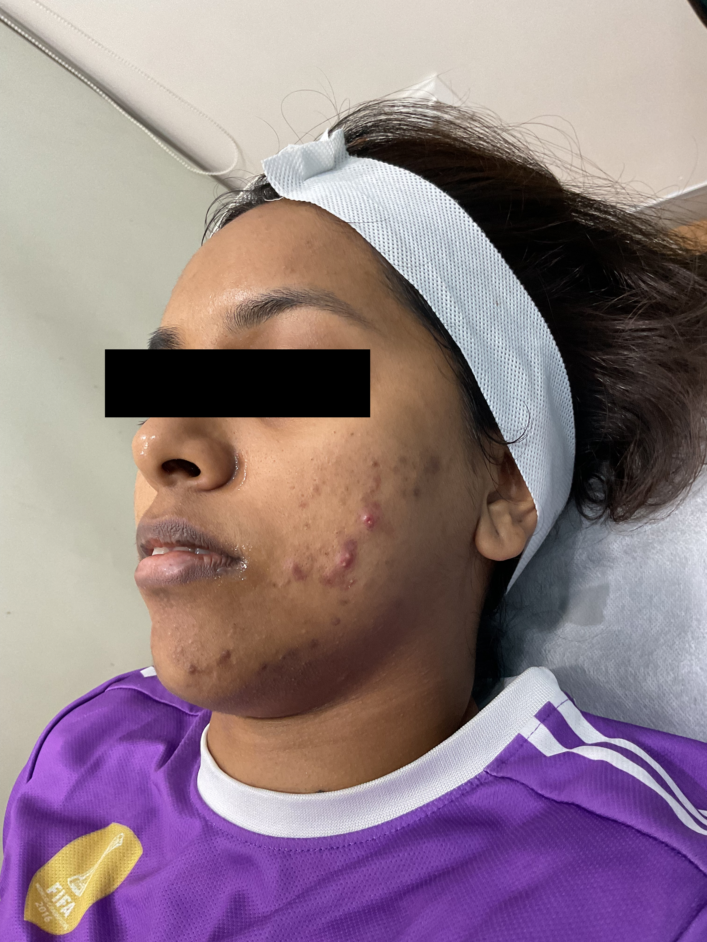 Before Growth Factor