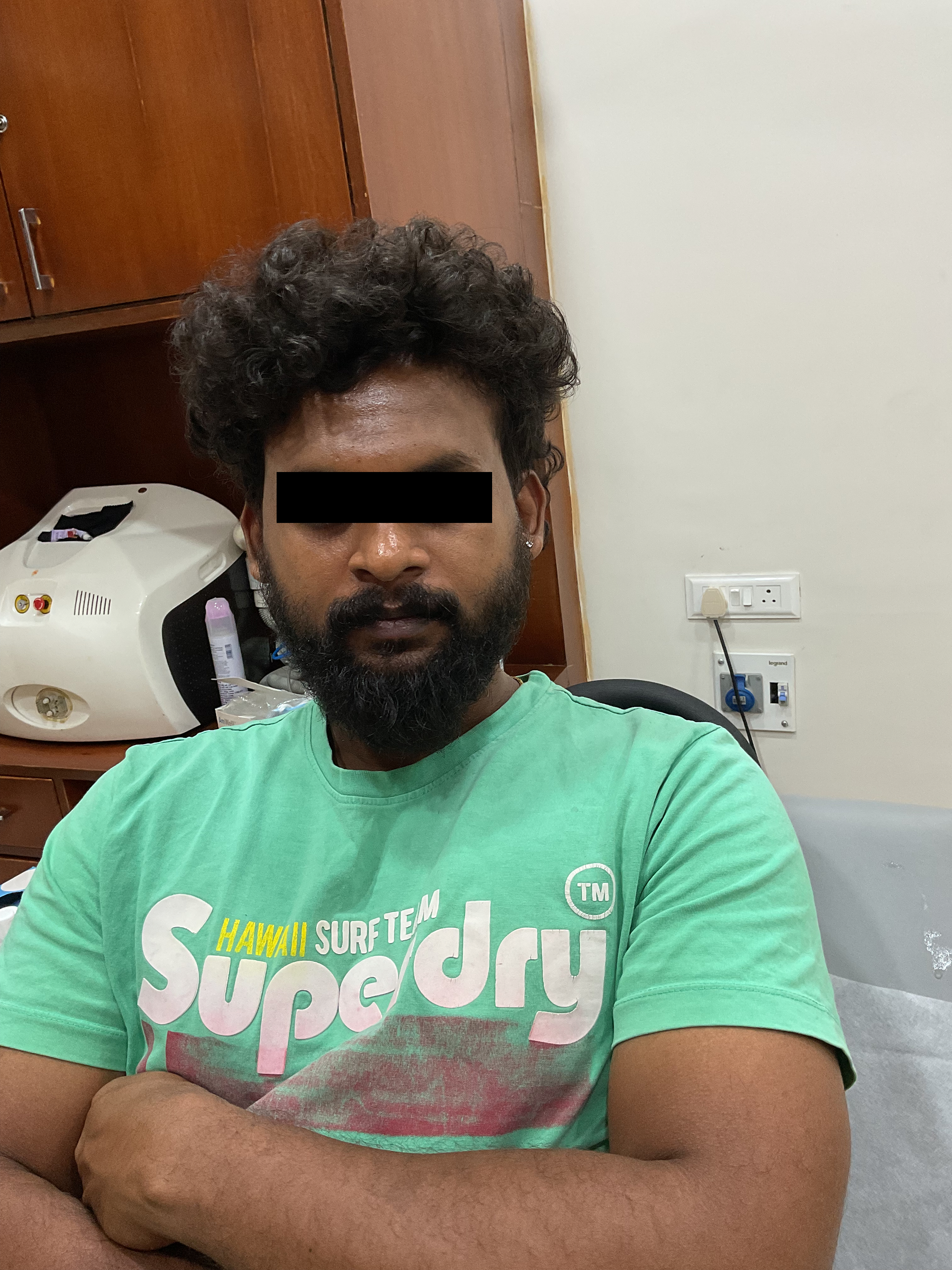 Before Acne Treatment